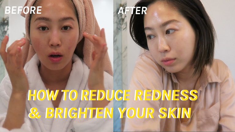 How To Reduce Redness and Brighten Your Skin