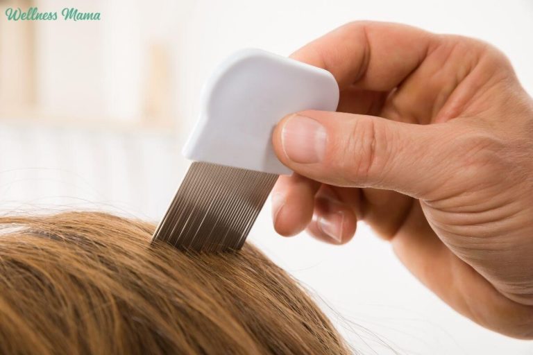 Natural Ways to Prevent & Get Rid of Head Lice